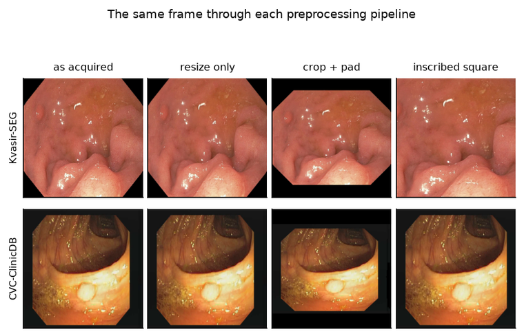 The same endoscopic frame shown through four preprocessing pipelines, for two source datasets