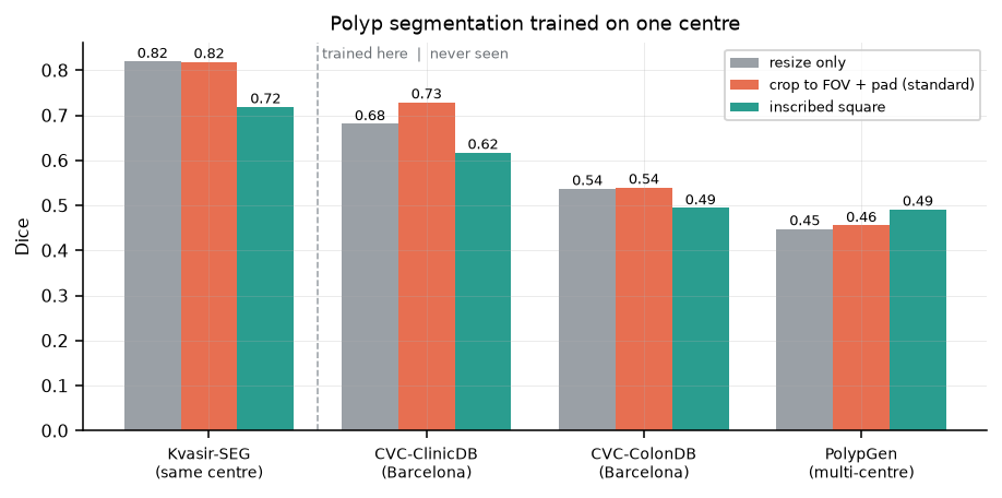 Polyp segmentation Dice per pipeline across four target datasets